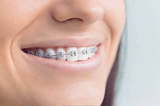 Best Wisdom Tooth Removal  in Elizabeth, NJ